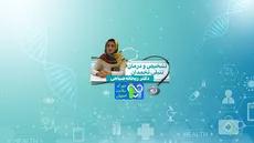 تشخیص و درمان سندرم تخمدان پلی کیستیک